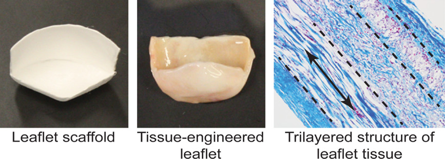 The leaflet scaffold, tissue-engineered leaflet and trilayered structure of leaflet tissue.